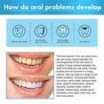 thumbnail image 5 of 3PCS Jorondy Teeth Mouthwash,30ml Herbal Brightening Oral Repair Foam Deeply Cleaning, 5 of 5