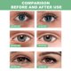 thumbnail image 2 of 30 pares de mascarilla para ojos de Aloe Vera, mascarilla debajo de los ojos con aminoácidos, mascarilla debajo de los ojos para el cuidado facial, mascarillas para los ojos para las ojeras, 2 of 3