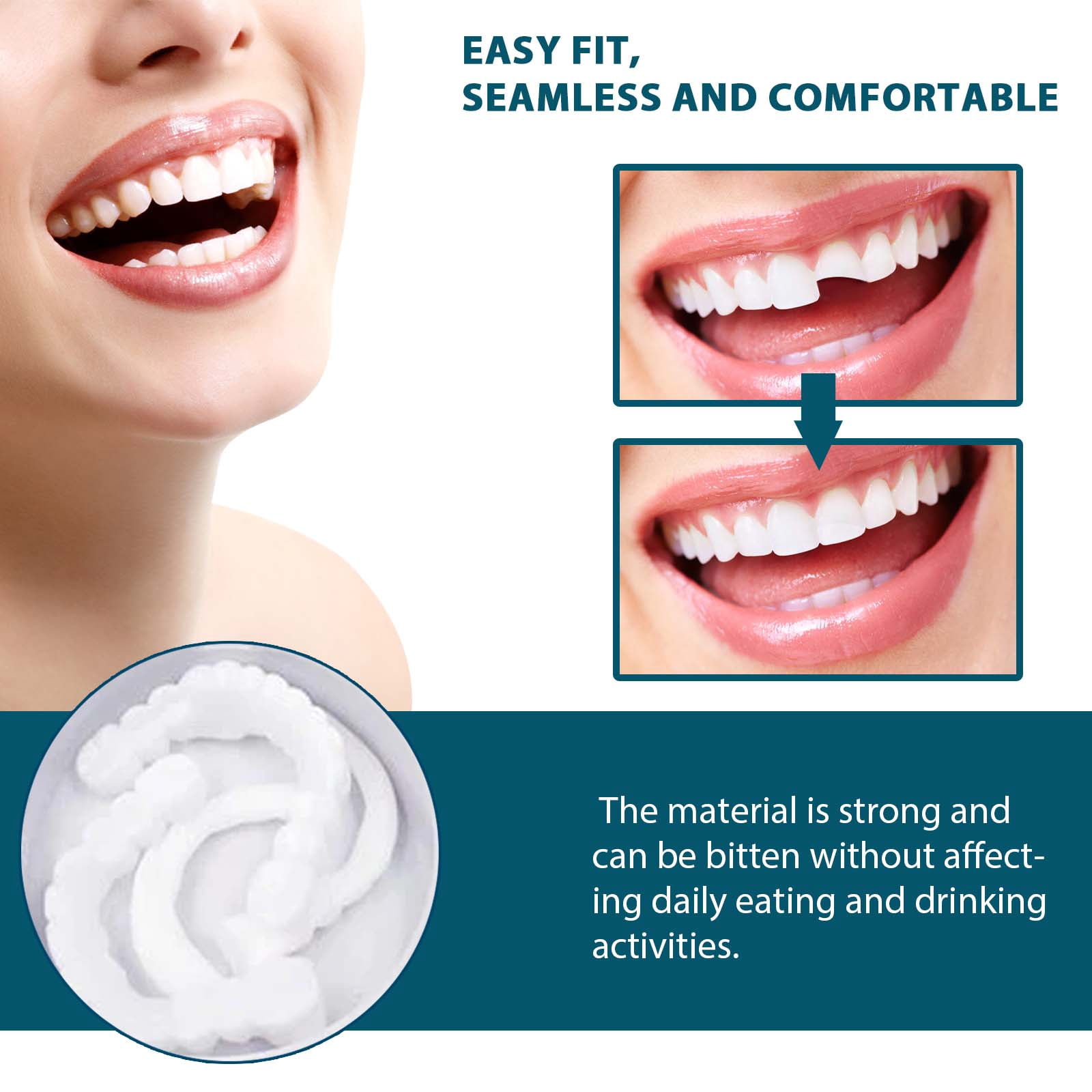 Alvantor Adjustable Buckle Teeth Kit, Temporary Fillings & Interdental Fillings, 1 Pair