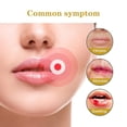 thumbnail image 2 of South Moon 60 parches Parche de miel para herpes labial Tratamiento de ampollas Oculta Protege Calma y oculta el herpes labial, 2 of 5