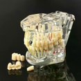 thumbnail image 1 of Dental Models Repairable Resin Models Of Diseased Teeth For Teaching And Research In Medicine And Dental Diseases, 1 of 4
