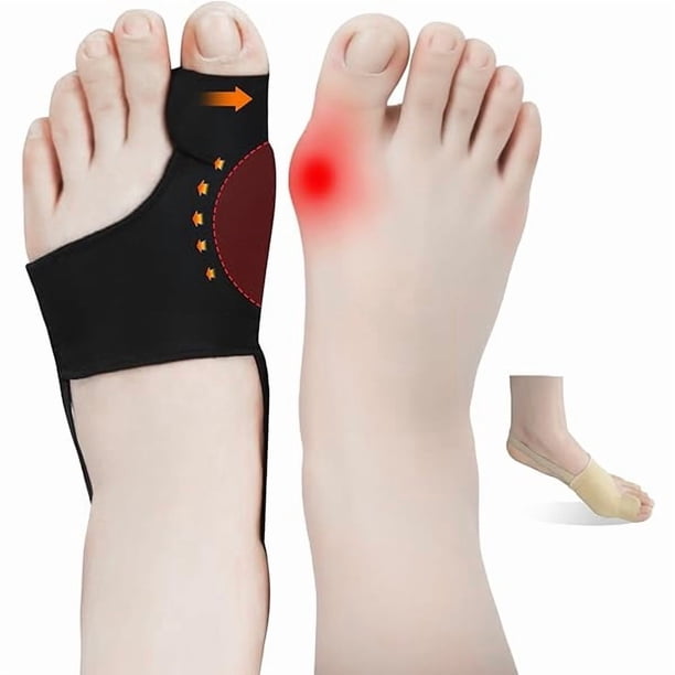 wonima44 4 PCS Bunion Corrector for Women & Man, Big Toe Separators, Premium Bunion Spacer, Toe Spacers Pain Relief, Comfortable & Breathable, Discreet and Washable for Day/Night (2 Black + 2 Beige)