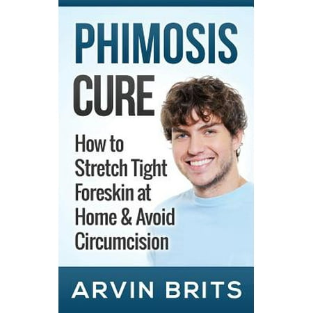 Phimosis Cure: Comment Étirer Tight Foreskin à la maison et éviter les Circoncision (agrandissement du pénis, Jelqing, Kegels, dysfonction érectile,