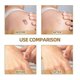 thumbnail image 3 of 60/120 Patches Skin Invisible Concealer Sticker Skin Tone Invisible Sticker Scar Pimple Mark Concealer Stickers, 3 of 5