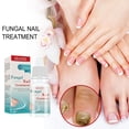 thumbnail image 2 of Nail Fungal Removal Essence 10ml Nail Fungal Removal Liquid Productos para el cuidado de los pies, 2 of 9