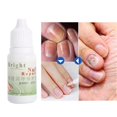 thumbnail image 4 of 10ml Natural Nail Care Liquid Deep Sterilization Fungus Removal Nail Repair Liquid, 4 of 4