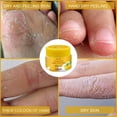 thumbnail image 4 of Crema bálsamo para talones agrietados HUOGUO para pies ásperos, secos y agrietados, 4 of 5