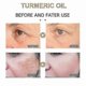 thumbnail image 5 of 30ml Turmeric Oil - Pure, Natural, Moisturizing, Anti-aging Serum for Lightening -, 5 of 5