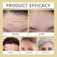 thumbnail image 4 of Forehead Wrinkle Patches, 24K Gold Anti Wrinkle Patches, Forehead Lines Mask, Smooth Fine Lines & Wrinkles, 24K Gold Collagen Patches for Forehead Wri, 4 of 5