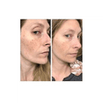 thumbnail image 4 of Retinol .5% in Squalane The Ordinary 30 ml, 4 of 4