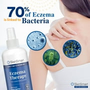 SkinSmart Antimicrobial Eczema Therapy with Hypochlorous Acid, Removes Bacteria so Skin Can Heal, for Adults, Kids and Seniors, 8 Ounce Clear Spray