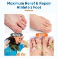 thumbnail image 7 of Athletes Foot Treatment Extra Strength - Effective Fungi Treatment Athletes Foot Spray - Itching and Odor Removal, 7 of 7