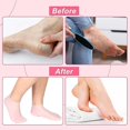 thumbnail image 5 of Calcetines de Silicona JINMJMXG 3 Pares Aloe Gel Antideslizantes, 5 of 5