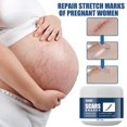 thumbnail image 4 of Scar Removal Cream Acne Scar Remover Cream Smooth Scar Lightening Cream, 4 of 9
