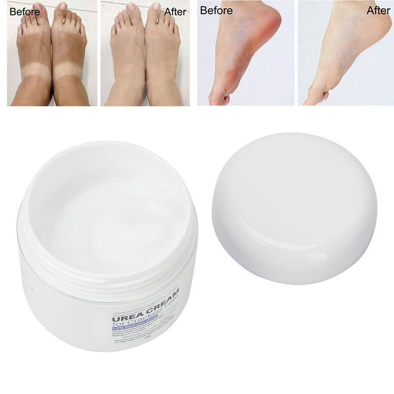 Ellocy Urea 42% Foot Cream for Dry Cracked Heels, Salicylic Acid, 5.29 Oz, Cracked  Heel Repair for Dry Cracked, Callus Remover, nail repair cream, foot lotion  f…