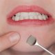 thumbnail image 4 of Stainless Steel Pore Cleaner Pore Cleaner Tool Acne Blackhead Removal Deep Cleansing Face Skin Care, 4 of 5