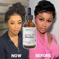 thumbnail image 5 of Scalp Stimulator Hair Growth Oil, Advanced Scalp Care Hair Growth Serum for All Hair Types, 5 of 5