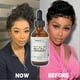 thumbnail image 5 of Scalp Stimulator Hair Growth Oil, Advanced Scalp Care Hair Growth Serum for All Hair Types, 5 of 5