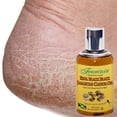 thumbnail image 4 of Fountain Mighty Roots Moisturizing Treatment For Hair Growth with Jamaican Black Castor Oil, 4 of 8
