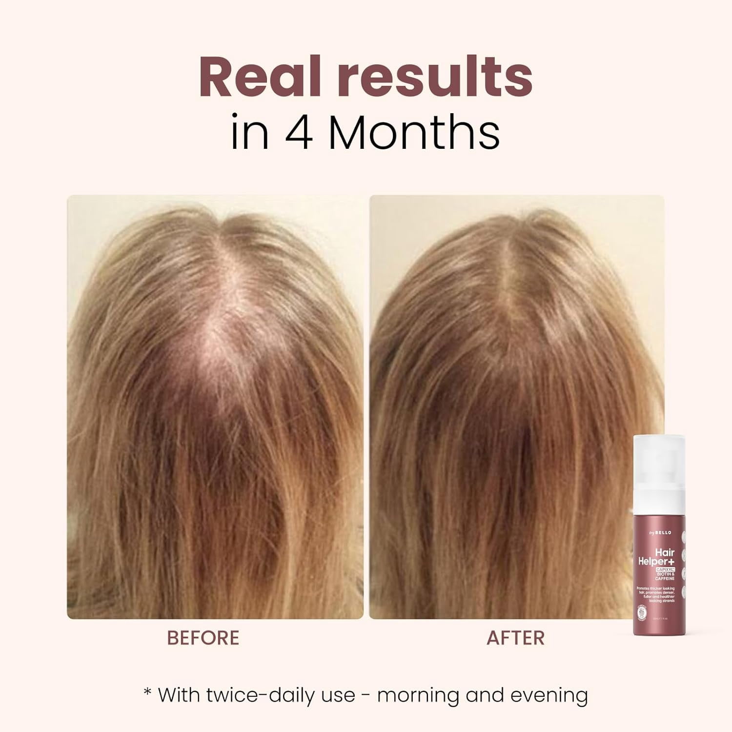 Trybello Hair Helper + Spray | Hair Growth Serum, powered by Capixyl | With Biotin, Castor Oil, Caffeine, Rice Water & Peptide Complex | Natural Treatment for Thicker, Fuller Strands | Vegan Formula