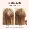thumbnail image 6 of Trybello Hair Helper + Spray | Hair Growth Serum, powered by Capixyl | With Biotin, Castor Oil, Caffeine, Rice Water & Peptide Complex | Natural Treatment for Thicker, Fuller Strands | Vegan Formula, 6 of 9