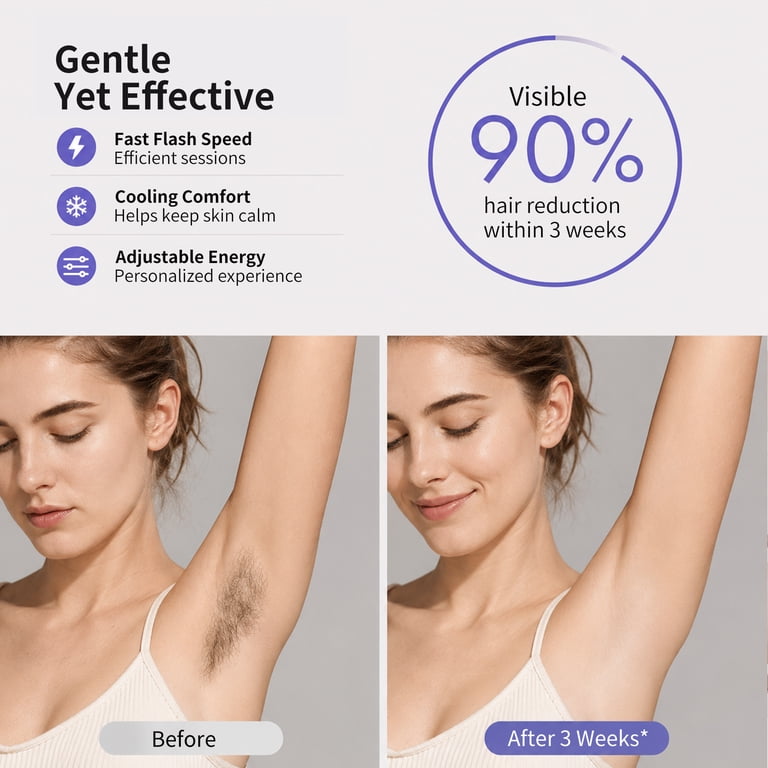 Cordless Ipl Hair Removal Device with Sapphire Cooling photo 3