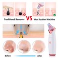 thumbnail image 3 of Electric Blackhead Suction Device with 5 in 1 Pimple Zit, 3 of 6