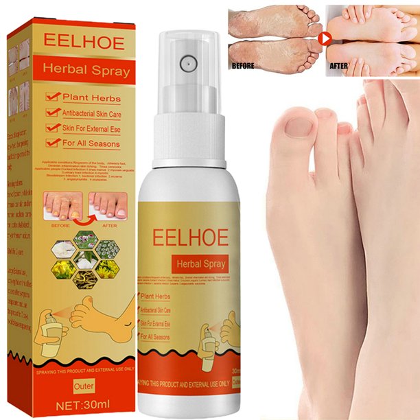Kiluex Foot Odor Eliminate Herbal Spray Antibacterial Moisten Remove