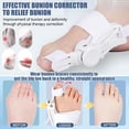 thumbnail image 3 of Bunion Corrector for Women & Men - Adjustable Big Toe Bunion Relief Toe Straightener Bunion Splints, Upgraded Press-Button Orthopedic Bunions Correction Suitable for Left/Right Feet -1PC Gray, 3 of 9