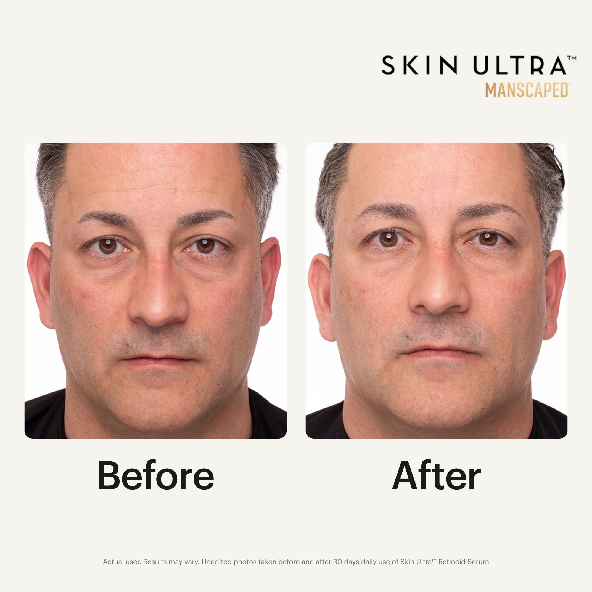 MANSCAPED® Skin Ultra™ Retinoid Serum - Dual Retinoid Age-Defying Formula with Squalane, Ceramides & Hyaluronic Acid to help Reduce Appearance of Fine Lines, Wrinkles & Dark Spots, 1 fl oz.