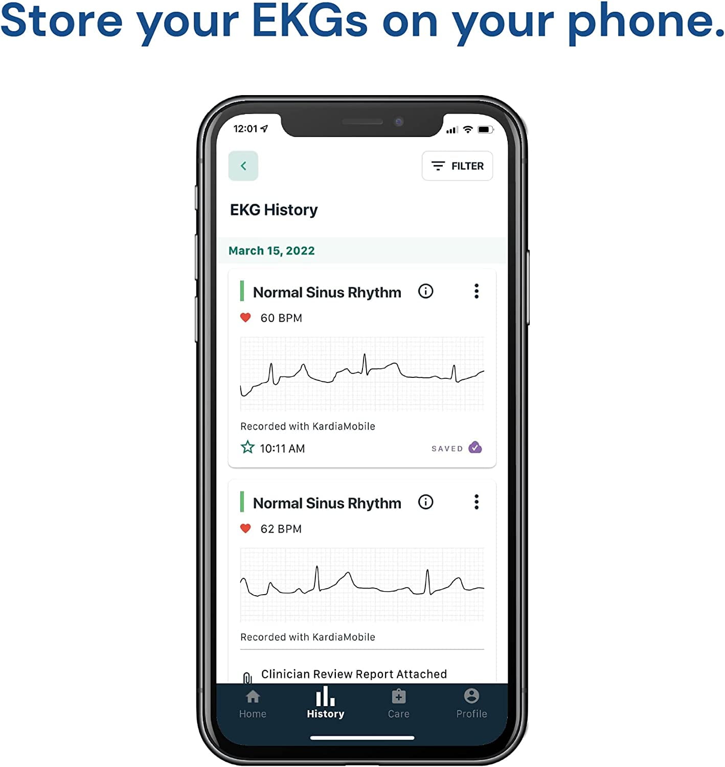 Buy KardiaMobile 1Lead Personal EKG Monitor Record EKGs at Home