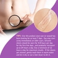 thumbnail image 5 of Purvigor Silicone Scar Tape Roll, 1.6” x60” Medical Tape for Wound Care Bandages Scars Strips for Surgical, 5 of 8