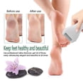 thumbnail image 3 of Charged Electric Foot File For Heels Grinding Pedicure Tools Professional Foot Care Tool Dead Hard Skin Callus Remover, 3 of 4