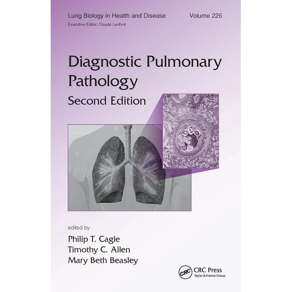 Diagnostic Pulmonary Pathology, (Paperback)