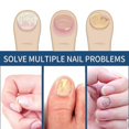thumbnail image 2 of 3packs Nail Repair Patches, Nail Fungus Treatments, Split Nail Repair, Waterproof And Breathable Foot Care Nail Repair E, 2 of 5