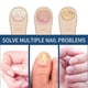 thumbnail image 2 of 3packs Nail Repair Patches, Nail Fungus Treatments, Split Nail Repair, Waterproof And Breathable Foot Care Nail Repair E, 2 of 5