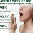 thumbnail image 2 of bad breath spray for instant freshness, 2 of 5