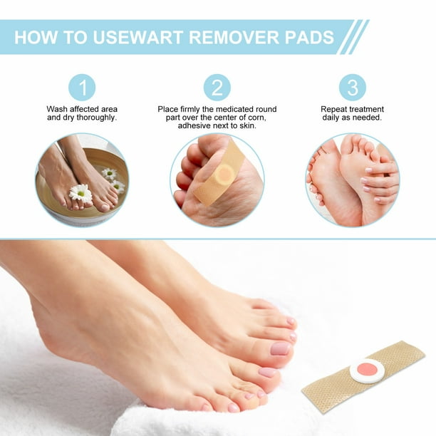 2PCS For Foot & Hand Pain Free Removal Oil Callus Corn Remover Liquid  Treatment