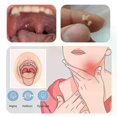 thumbnail image 3 of LED Light Stainless Steel Remover Mouth Cleaning Care Tools Tonsil Stone Remover 1Pcs Ear Wax Tonsil Stone Remover Tool, 3 of 5