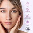 thumbnail image 5 of LivaClean 330 CT Pimple Patches for Face w/Salicylic Acid, Tea Tree Oil & Calendula Oil - Four Sizes - Pimple Patch, Hydrocolloid Patch, Acne Patches for Face, 5 of 6