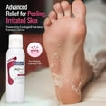thumbnail image 2 of Footlogix Peeling Skin Formula With Spiraleen 4.2 oz / 125 ml, 2 of 6