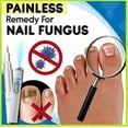 thumbnail image 2 of 2pcs Anti-fungal Home Treatment Set Toenail Treatment Pen, Onychomycosis Repair Laser And Pen,quick And Visible, Safe And Easy To Use-xgm-xgm, 2 of 5