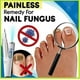 thumbnail image 2 of 2pcs Anti-fungal Home Treatment Set Toenail Treatment Pen, Onychomycosis Repair Laser And Pen,quick And Visible, Safe And Easy To Use-xgm-xgm, 2 of 5