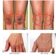thumbnail image 5 of 2 Pcs Brightening Spotless Oil Dark Spots Removal Age Hyper Pigmentation 10ml, 5 of 5
