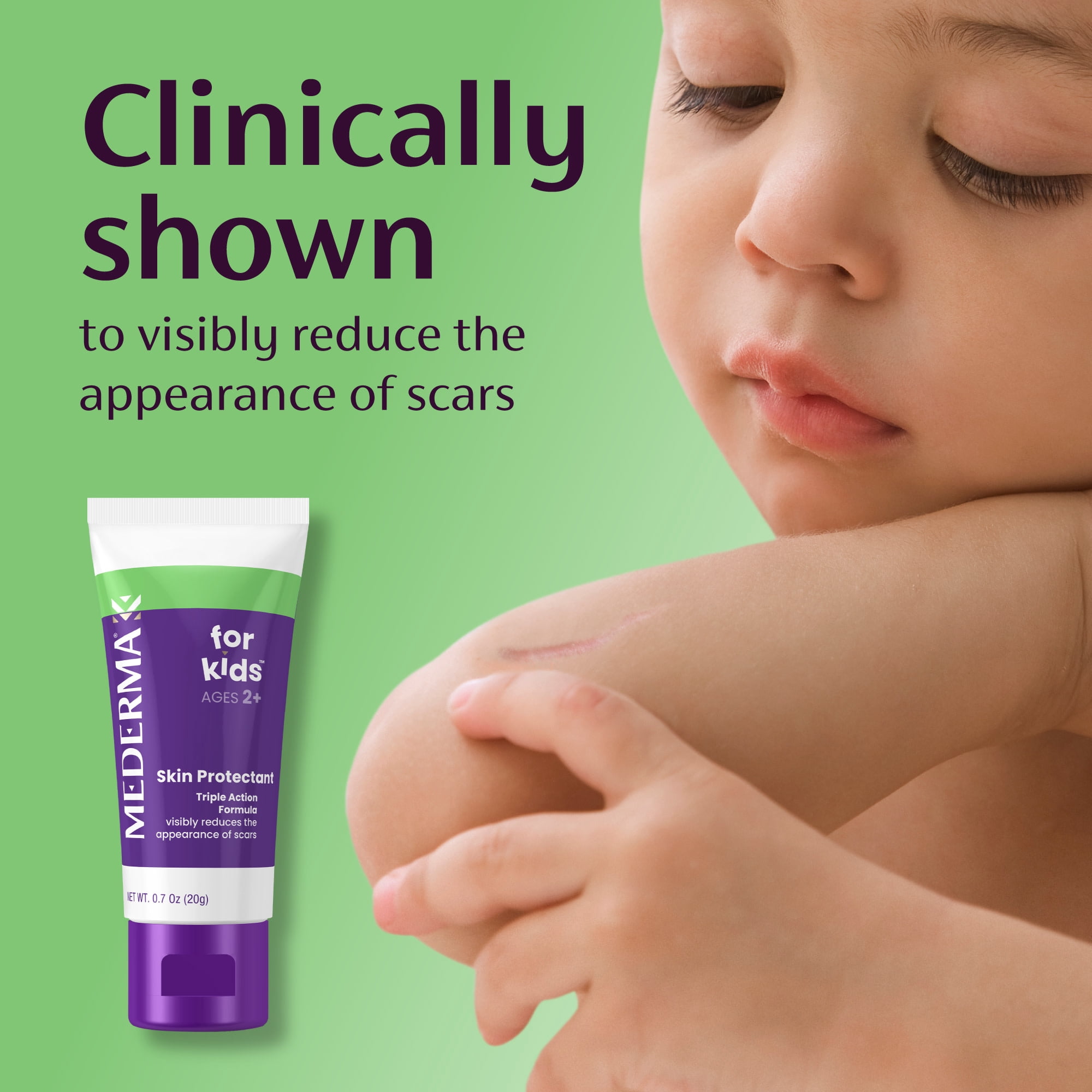 Mederma Scar Gel for Kids, Treatment for Old and New Scars, Grape Scented, Ages 2+, 0.7 Ounce