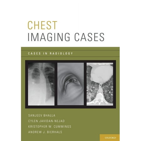 UPC: 9780195394535 | Cases in Radiology: Chest Imaging Cases (Paperback)
