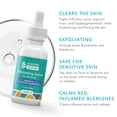 thumbnail image 2 of Serum Almond Clear Body Clear para el acné de nivel 2, 120 ml, 2 of 8