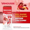 Vamousse Lice Treatment Mousse For Kids & Adults, Kills Super Lice