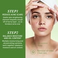 thumbnail image 4 of Price Drop Coconut oil Essential oils Acne Oil, Olive Oil, Acne Cleansing Oil, Acne Scar Lightening Olive Oil, Skin Care Oil ,30ML(buy 2 get 10% off), 4 of 4
