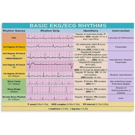 Basic ECG Rhythms Poster, EKG Heart Rhythms, EKG Knowledge (6) Canvas Painting Wall Art for Bedroom Living Room Decor